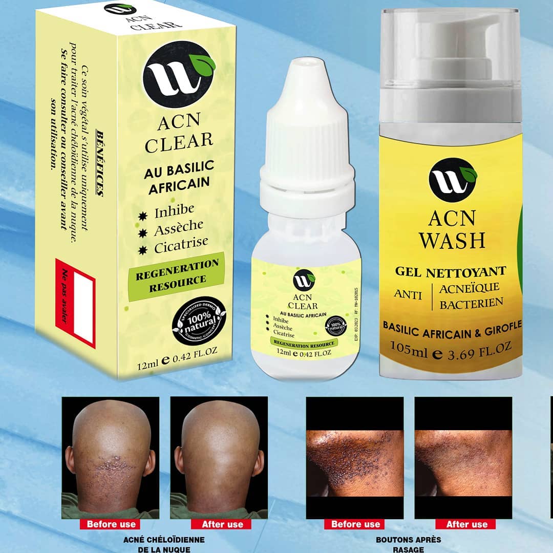 Crème Réparatrice Anti-Imperfections Ada Cosmetiques – Stop Chéloïdes Et Acnés De Nuque, 50g