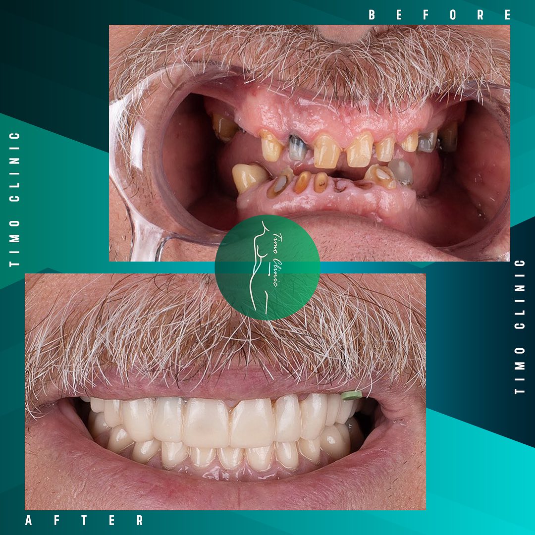 This... - Timo Clinic - Hair Transplant & Cosmetic Surgery