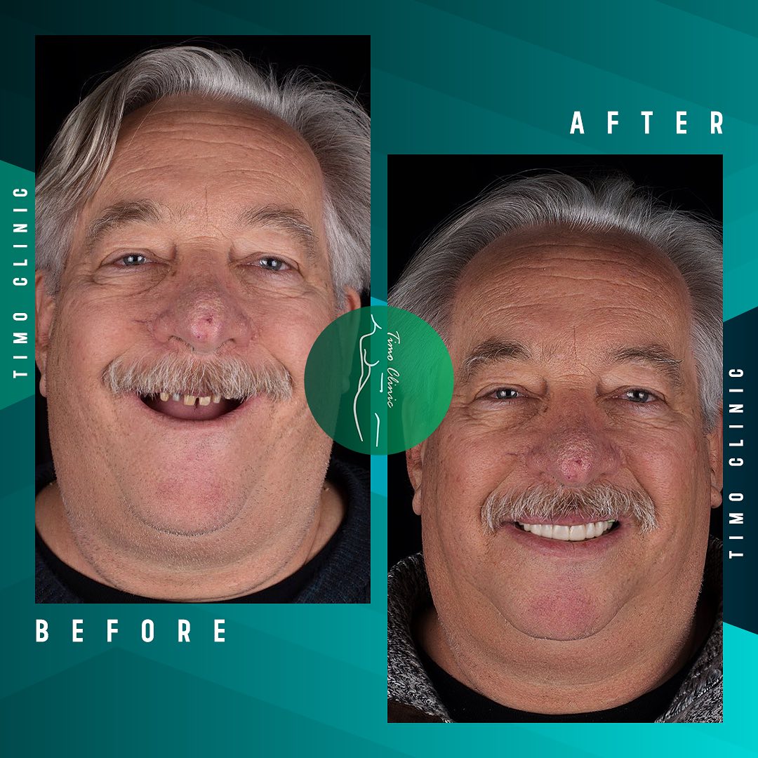 This... - Timo Clinic - Hair Transplant & Cosmetic Surgery