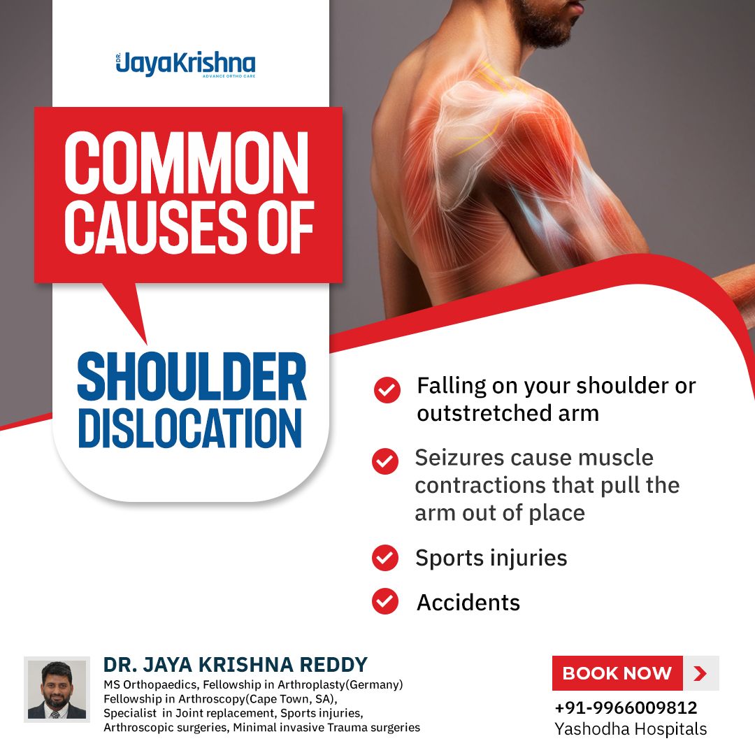 Dr.Jaya - Shoulder dislocation is an injury that occurs when the upper ...