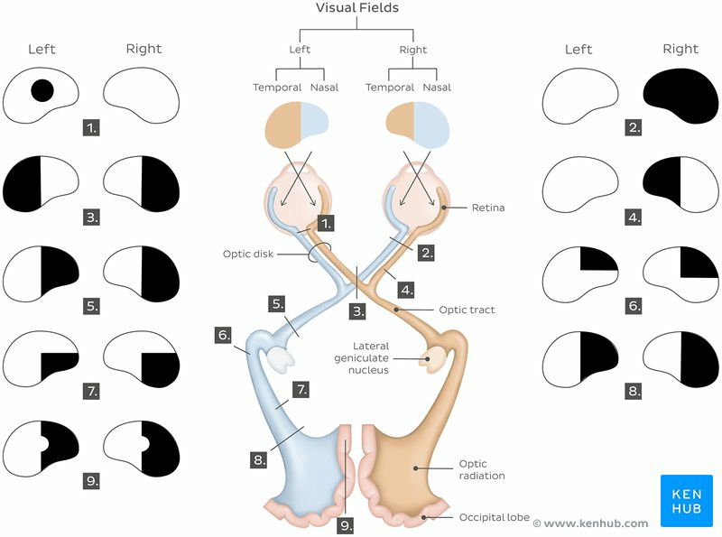 Dr. - #Neurology #Neurologic_exam The 2nd (optic) cranial nerve, visual ...