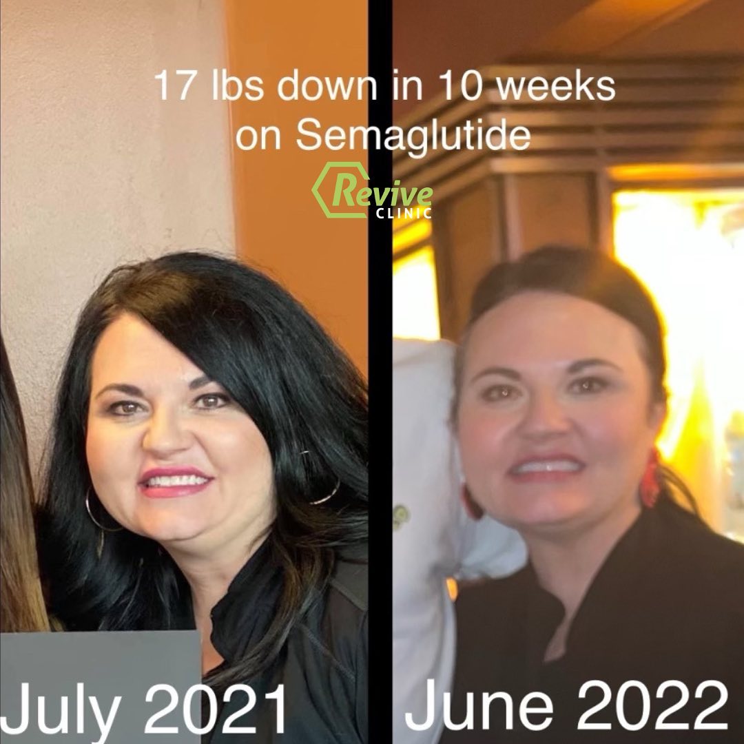 tirzepatide for $99 a month Why Weight Loss Plateaus Option:1 Month Supply Cruelty Free