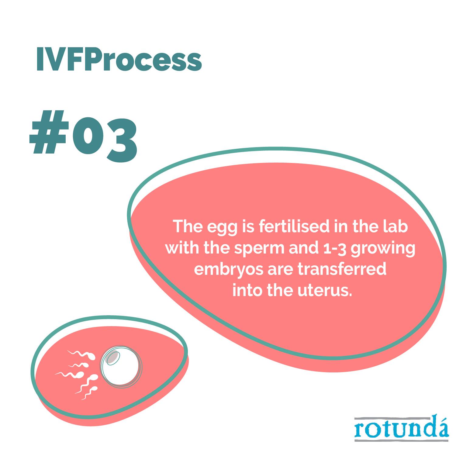 Rotunda IVF - IVF- In vitro Fertilisation explained in three steps. # ...
