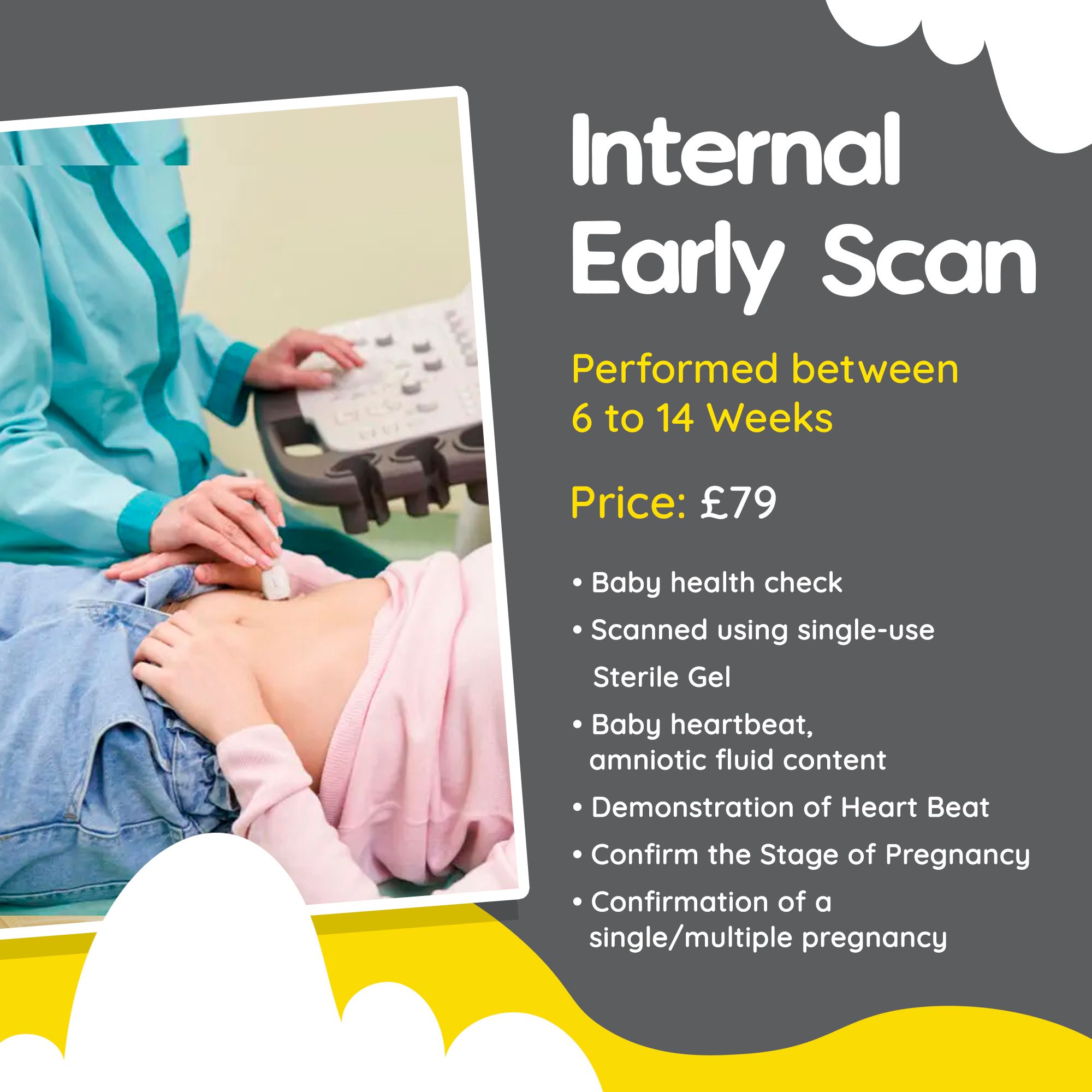 Bump2Baby Scan | Ashford