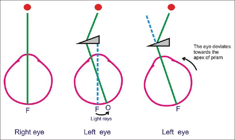 Future - Future X Lenses The Frame Measurements and Markings or boxing ...