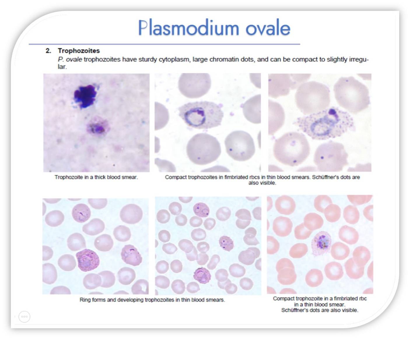Hematology | 🌹 Key Morphological Features of Plasmodium ovale 🌹 | Facebook