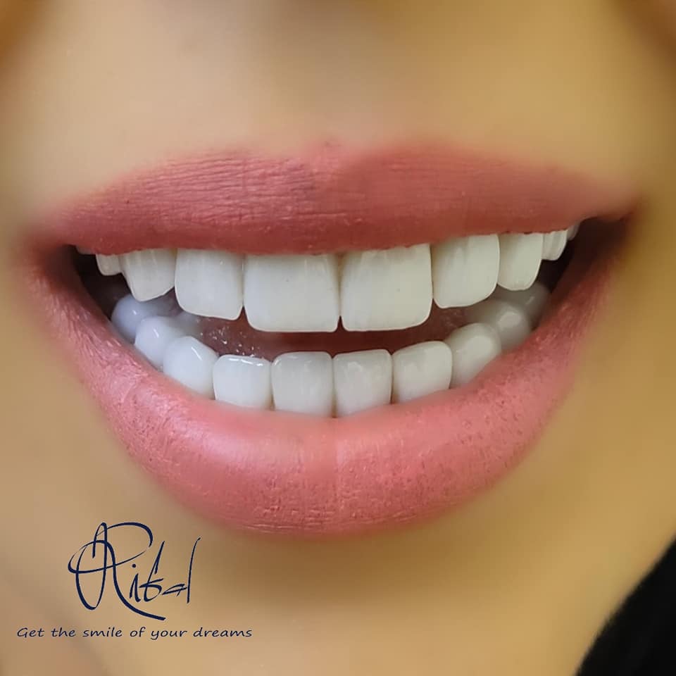 🔹تصميم... - Dr Ribal Kusseibati - الدكتور ريبال قصيباتي | Facebook
