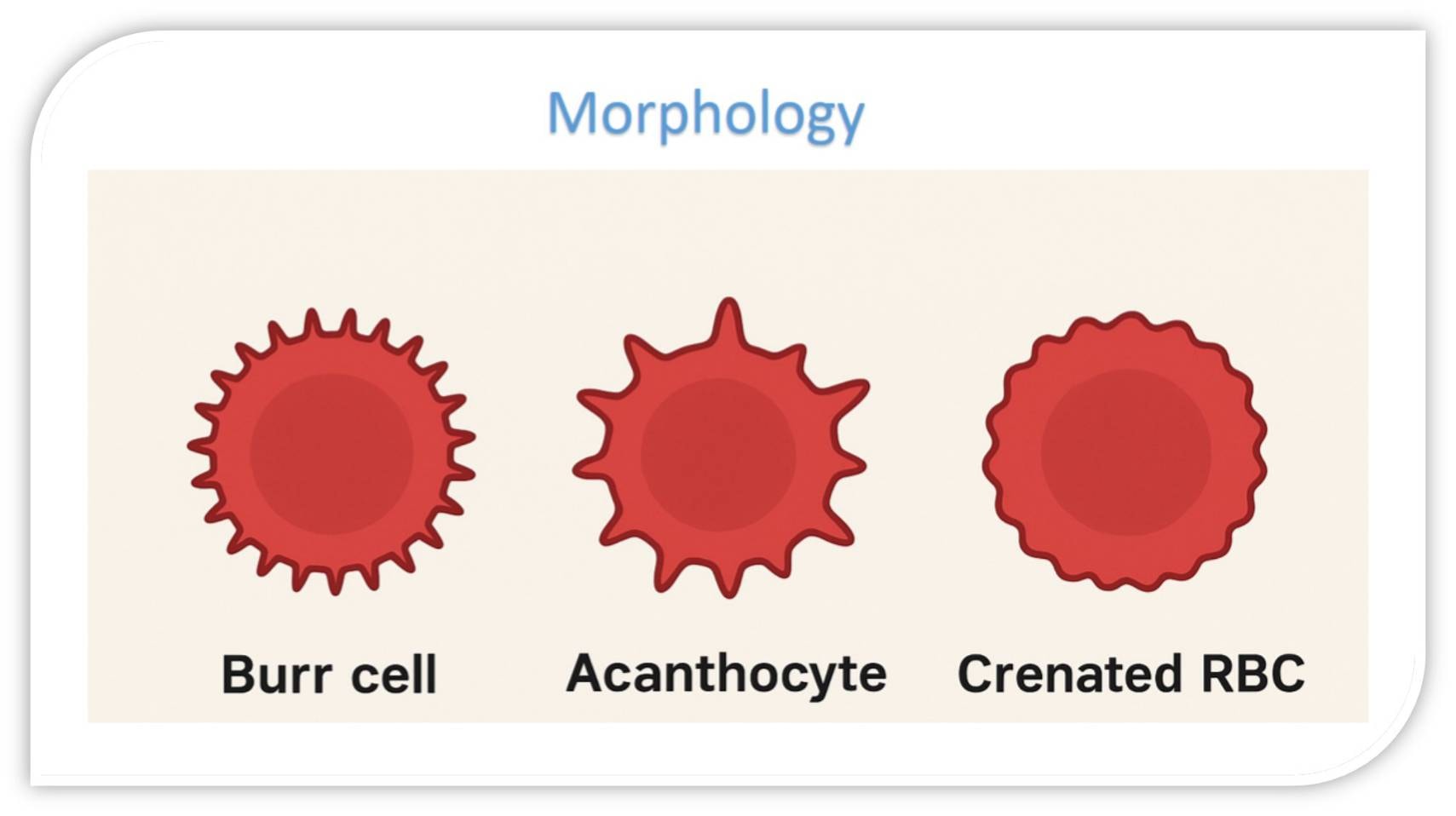 Medical Lab Technology MLT | 🍁Burr cell (Echinocyte) 🍁 | Facebook