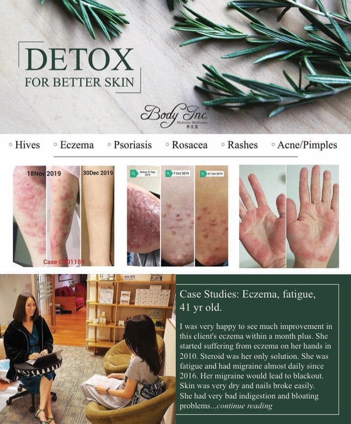 BODY INC. - Detox for better skin! 💫 . • Hives • Eczema •... | Facebook