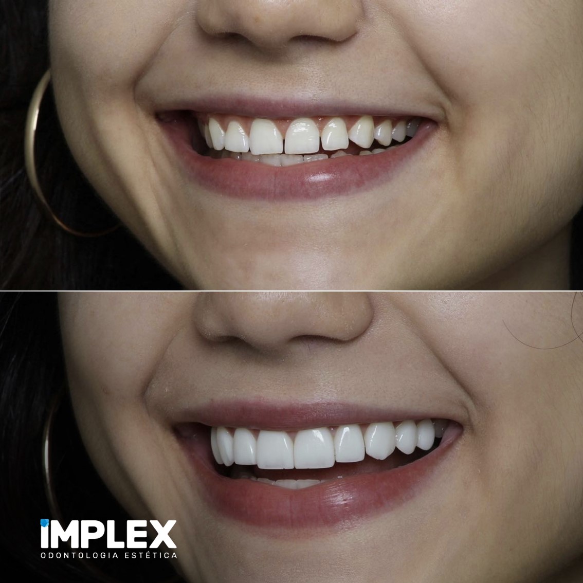 Implex Odontologia | Umuarama PR
