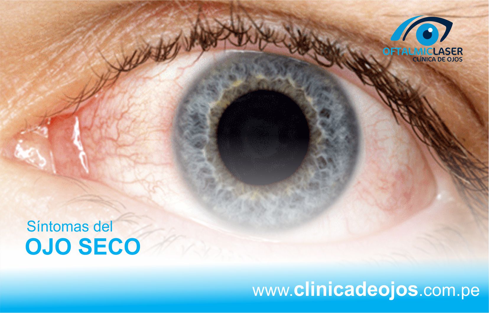 #QuédateEnCasa... - Clínica de Ojos Oftalmic Laser | Facebook