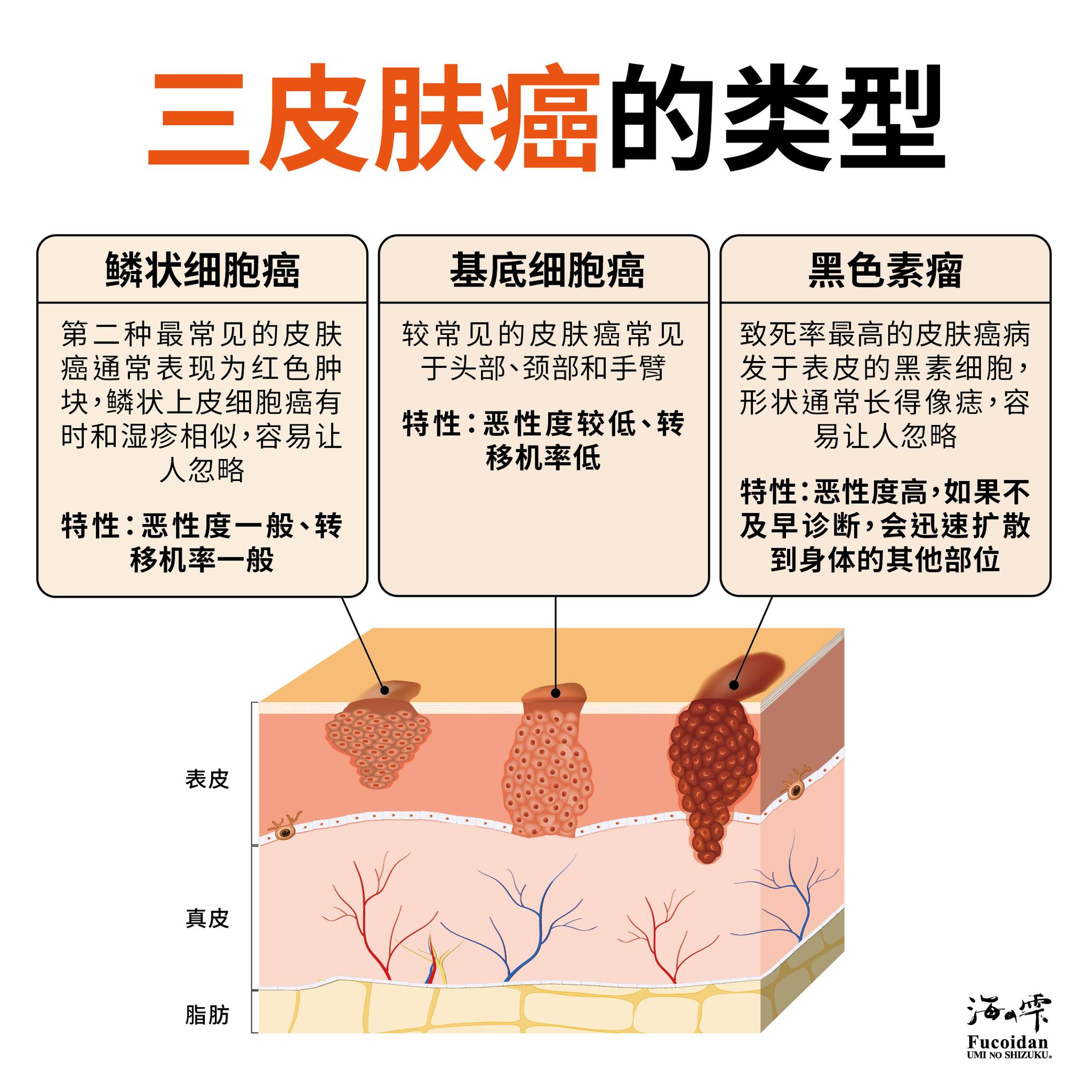 3 皮肤癌的类型 皮肤癌所指的是皮肤表层上的恶性肿瘤,... - Umi No Shizuku海之滴褐藻糖胶 新加坡