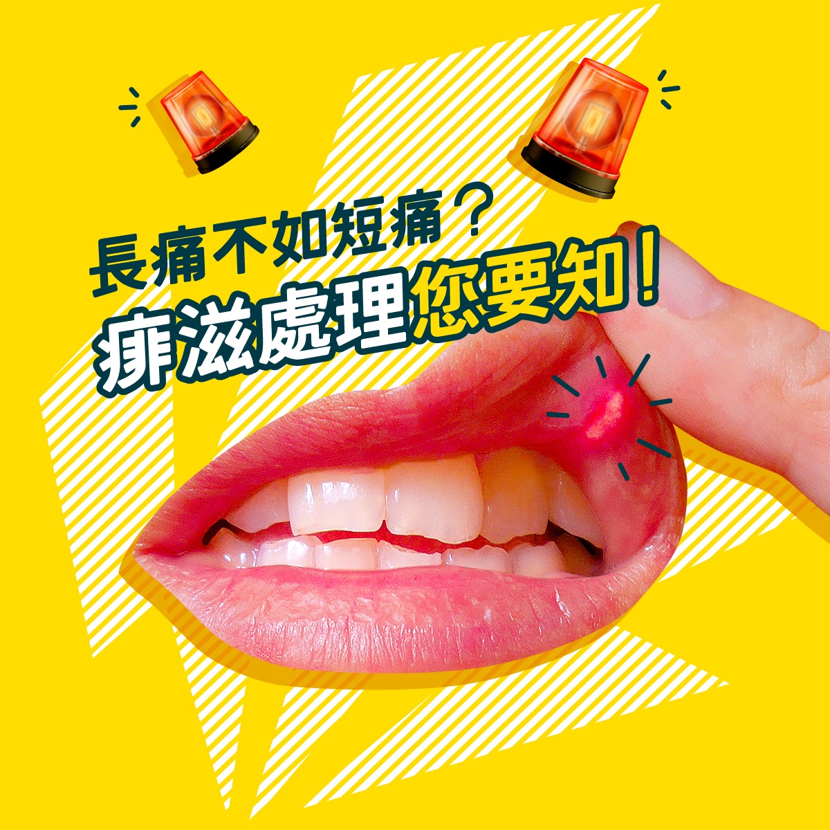 【痱滋出沒注意😖】 「哎呀！咬到咀唇，又生痱滋啦！」... - Sun Life Hong Kong