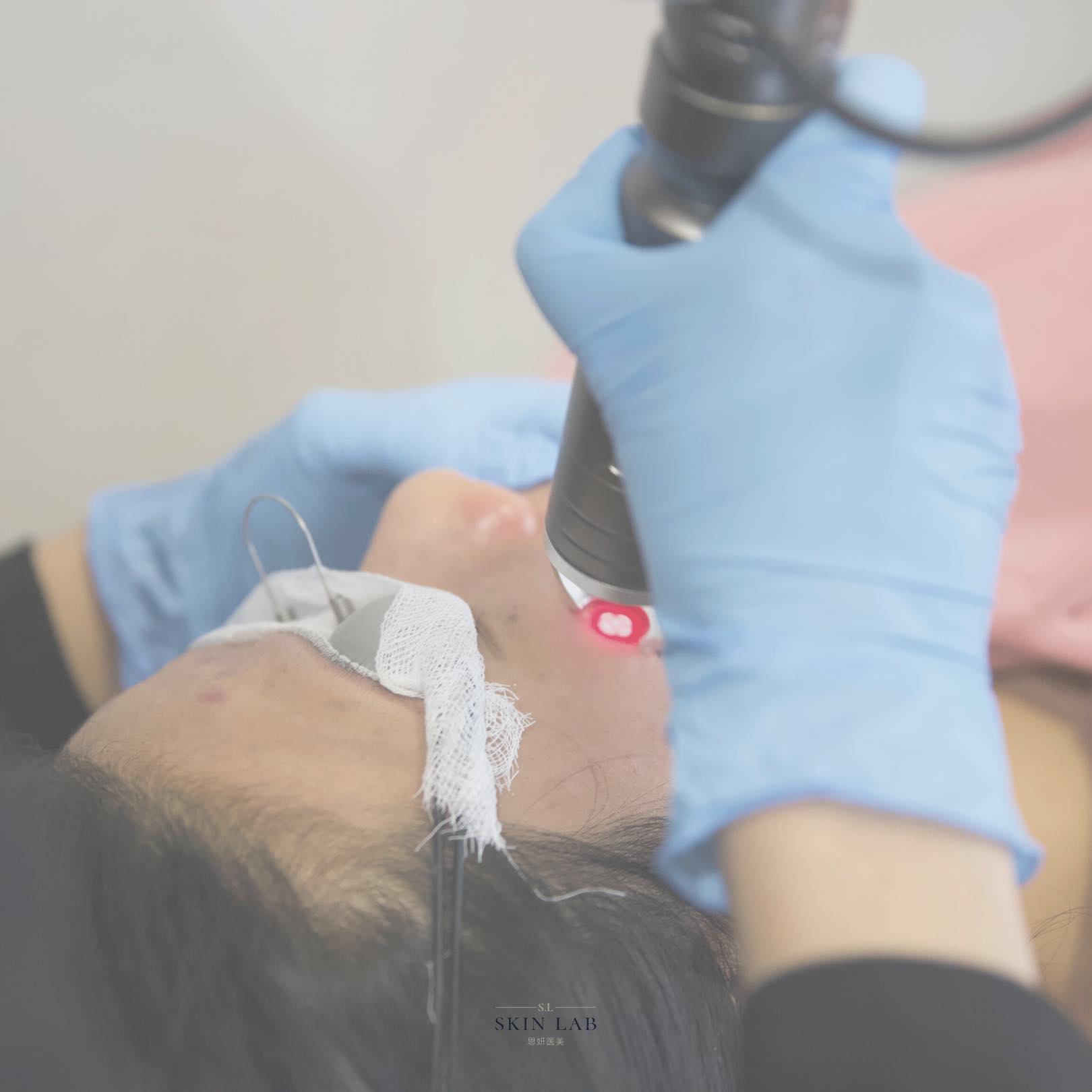 Skin Lab 思妍医美 - 皮秒是激光原理，采用创新技术，对色素颗粒的击碎更为彻底，而对周围组织的损伤更小。人体的...