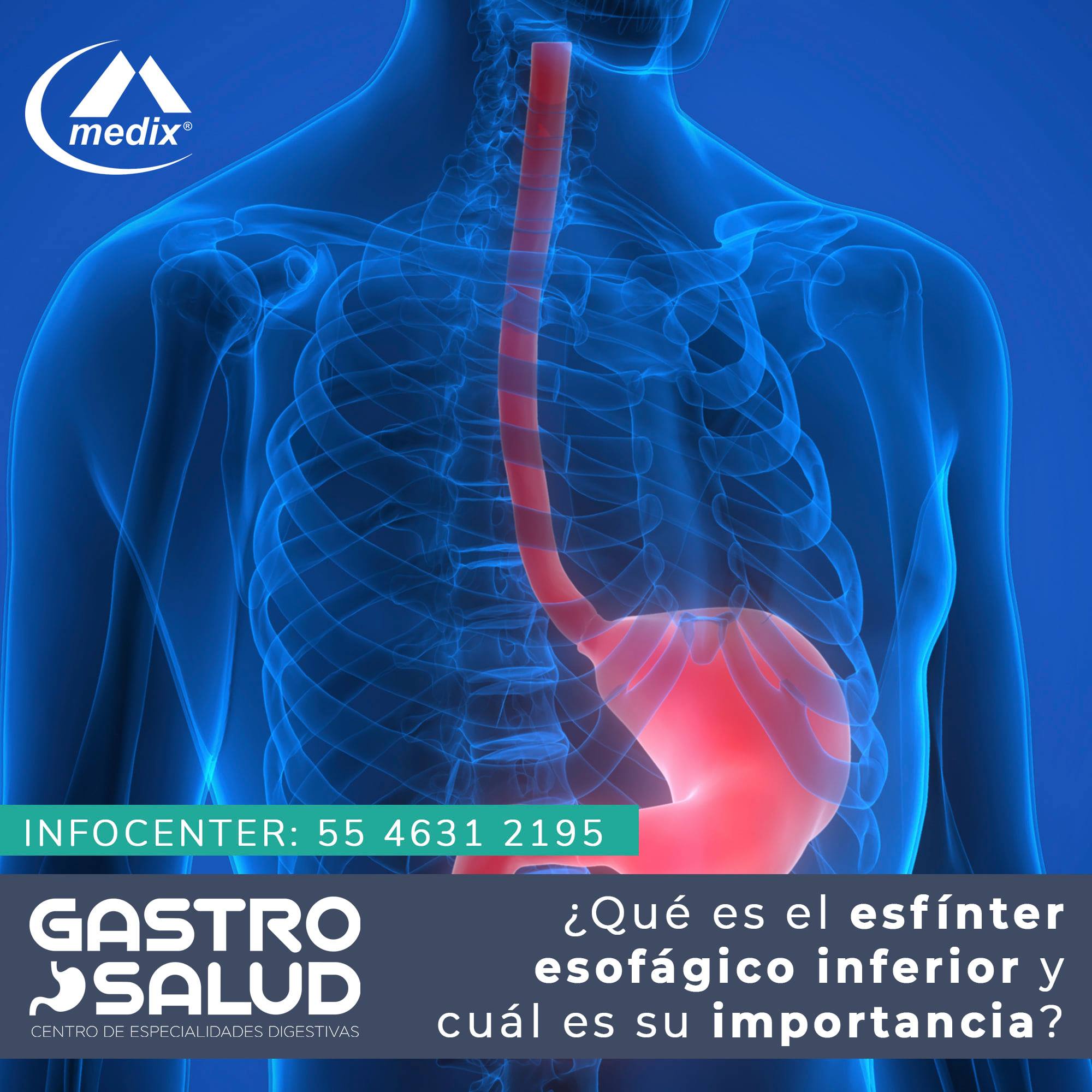 GastroSalud MX - ¿Qué es el esfínter esofágico inferior y... | Facebook