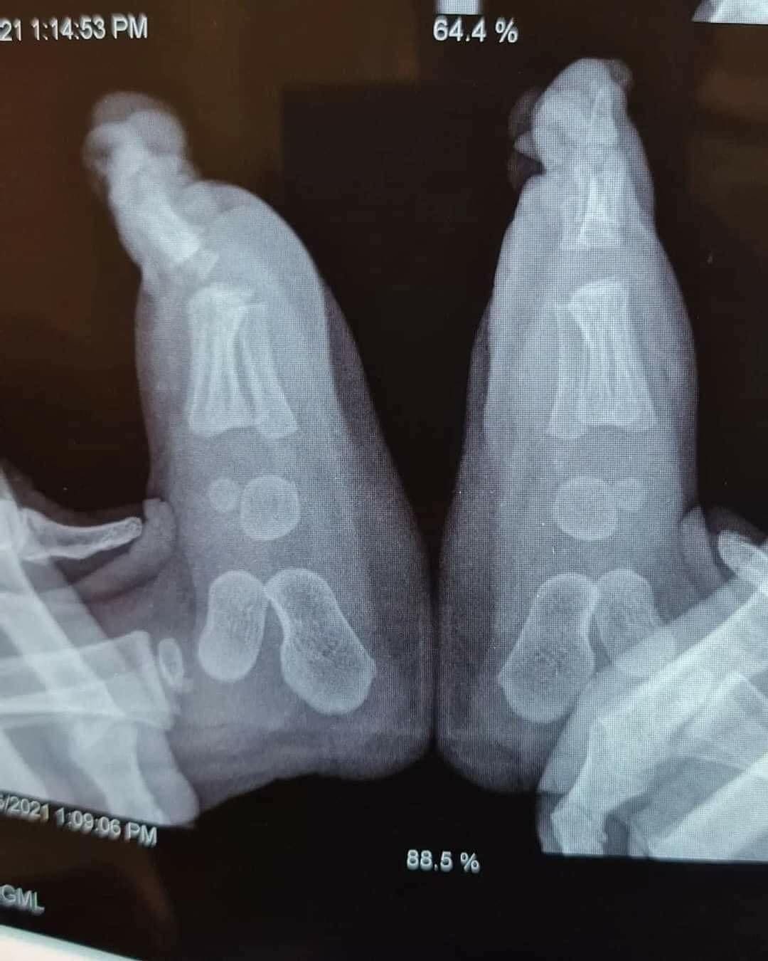 Je - 🚨 MESSAGE IMPORTANT 🔴 L'image est une Radiographie d'un patient ...