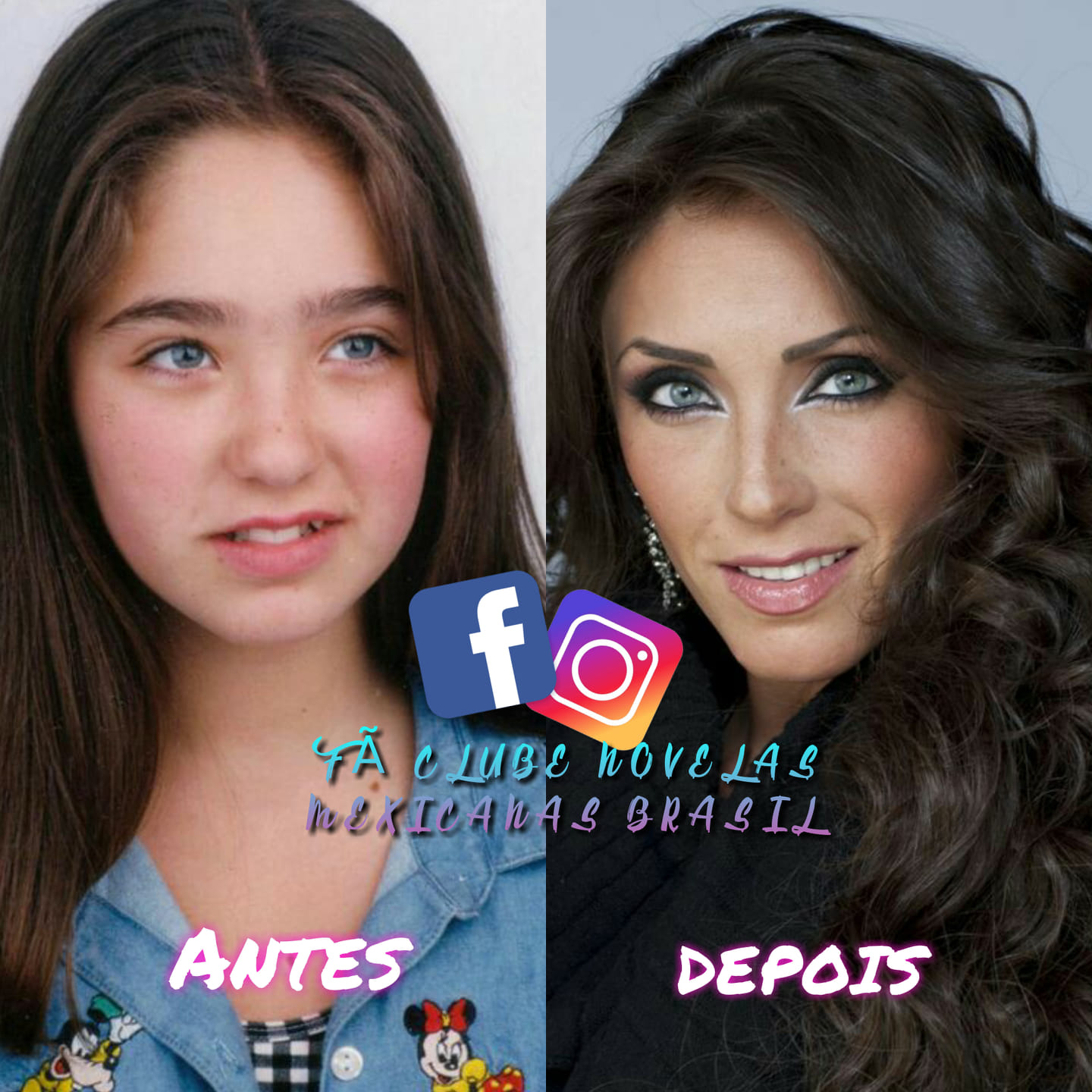 Anahi Antes E Depois Da Anorexia