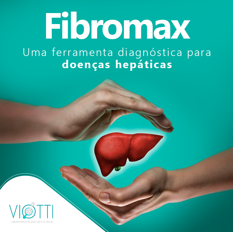 🔬🧫 O Fibromax e uma... - Grupo Ribeiro - Medicina Diagnóstica | Facebook