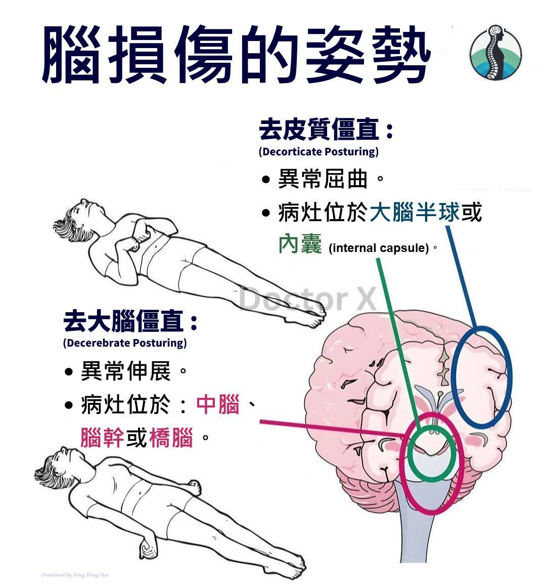 臨床筆記社團 | # 🛜**腦損傷的姿勢 (Posturing in Brain Injury):** | Facebook