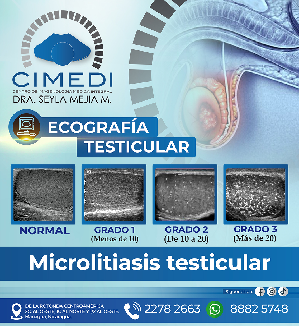 Cimedi - ⚕️ Microlitiasis testicular es la presencia de pequeñas ...