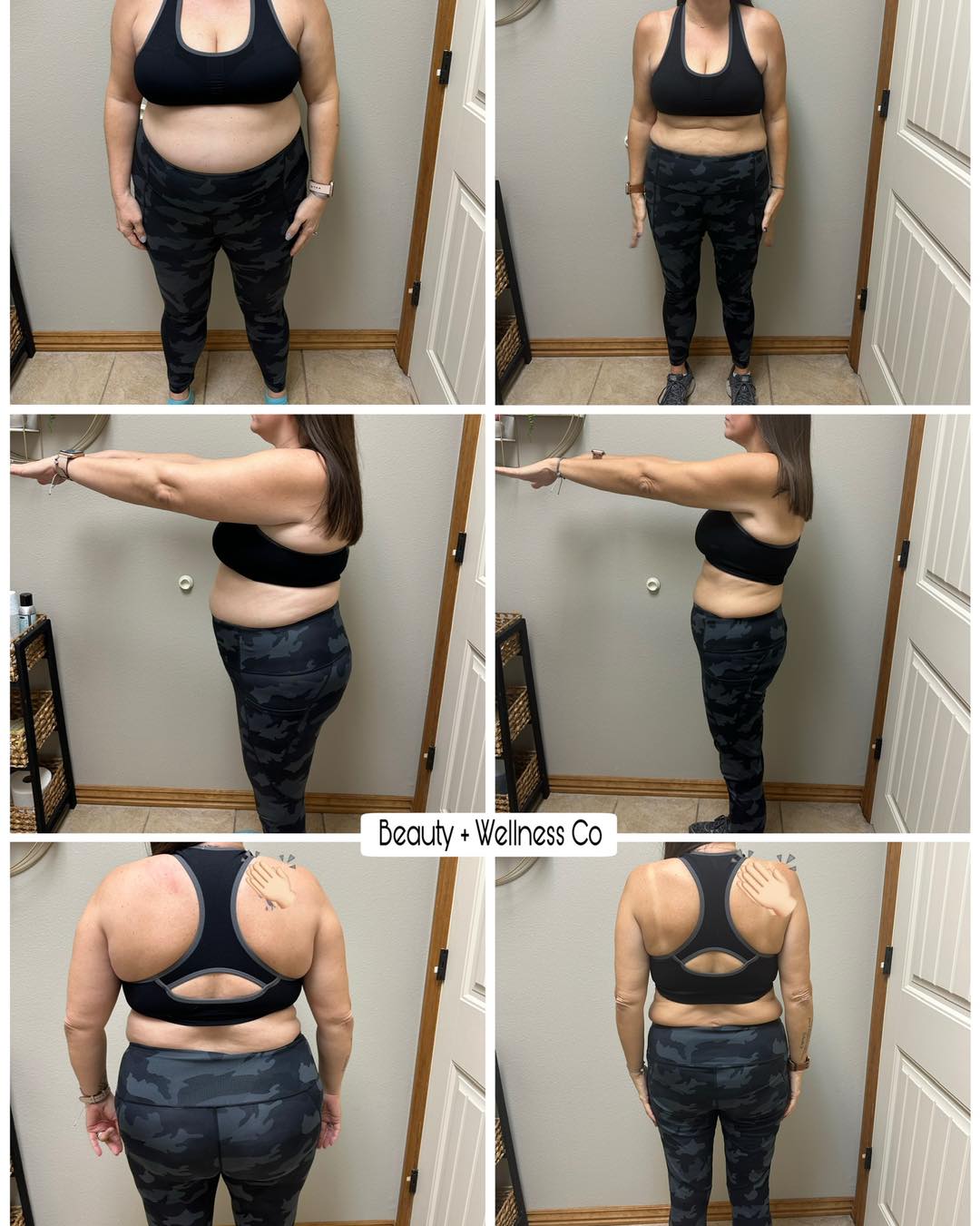 semaglutide columbia mo Weight Loss Management in Columbia, Who prescribes weight loss injections