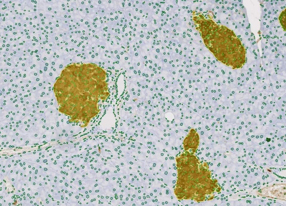 TissueGnostics - IHC META CELLS This StrataQuest App... | Facebook