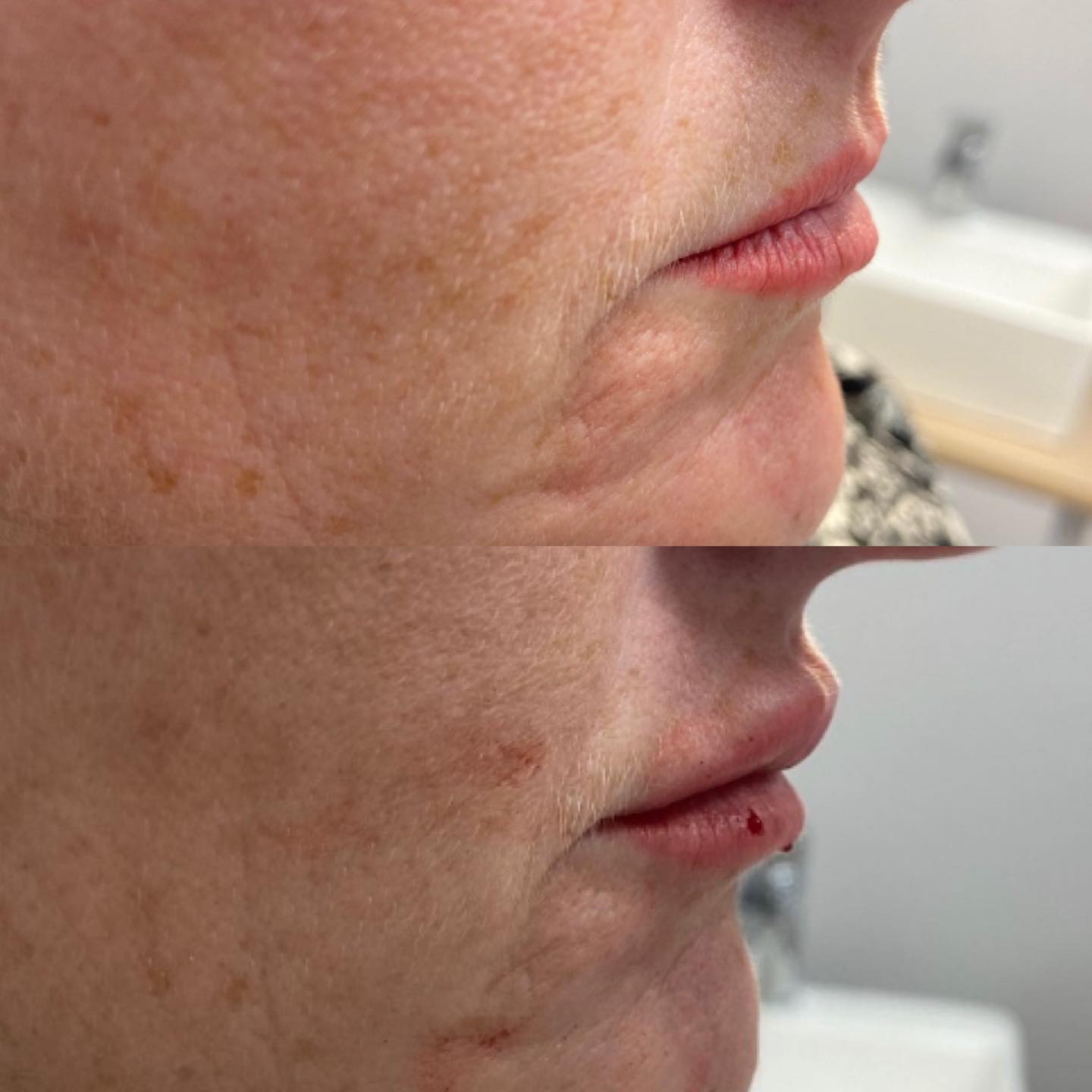 Sys Aesthetics | Irvine