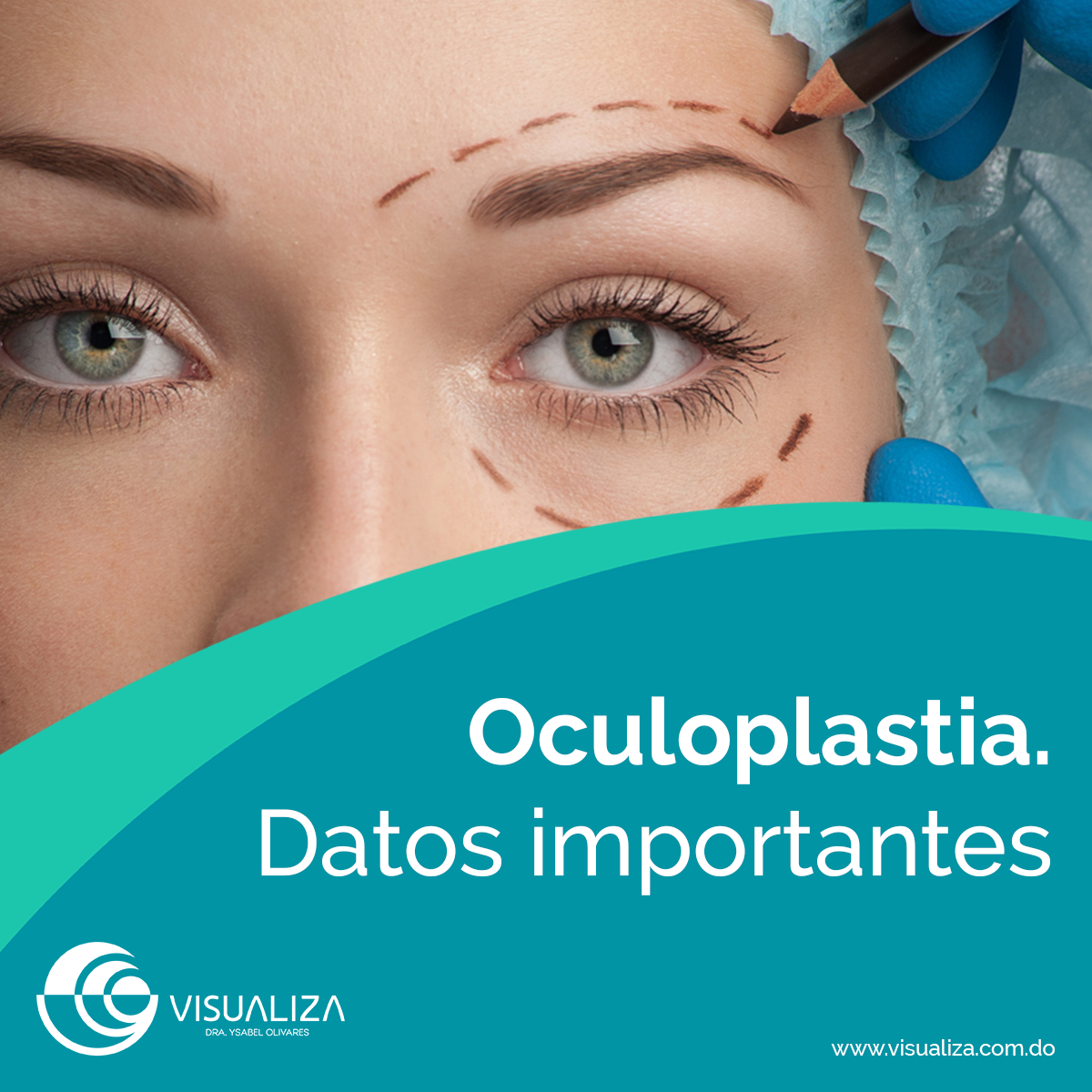 Oculoplastia. Datos... - Visualiza Centro Oftalmológico | Facebook