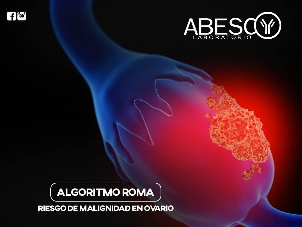 ABESCO - ROMA™ (Algoritmo de Riesgo de Malignidad Ovárica)...