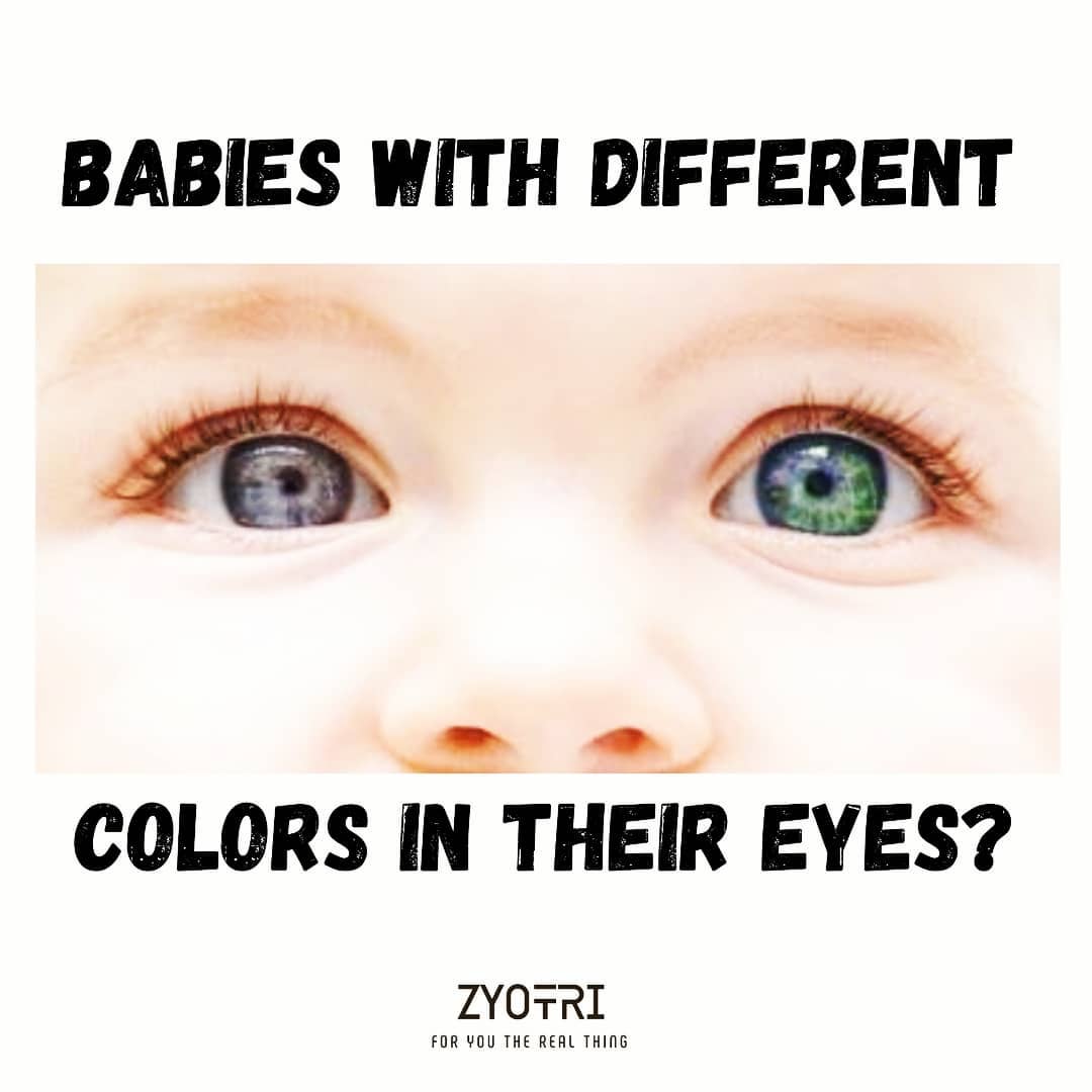 Zyotri - It is called Heterochromia 👀. It is a very rare trait ...