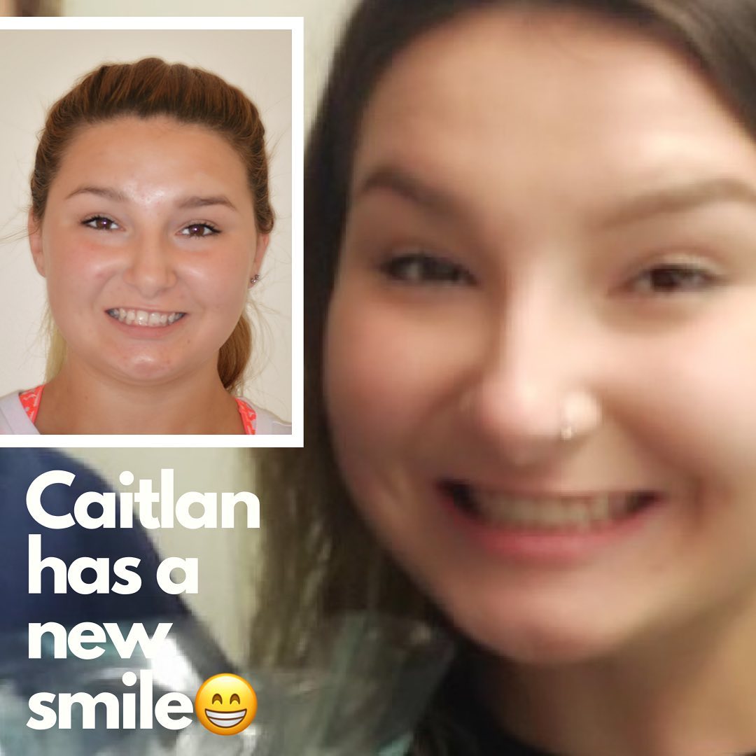 Congratulations Caitlan on your... Coastline Orthodontics