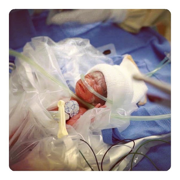 NICU - NICU Cheer wishes gorgeous Amelia a very happy 1st birthday ...