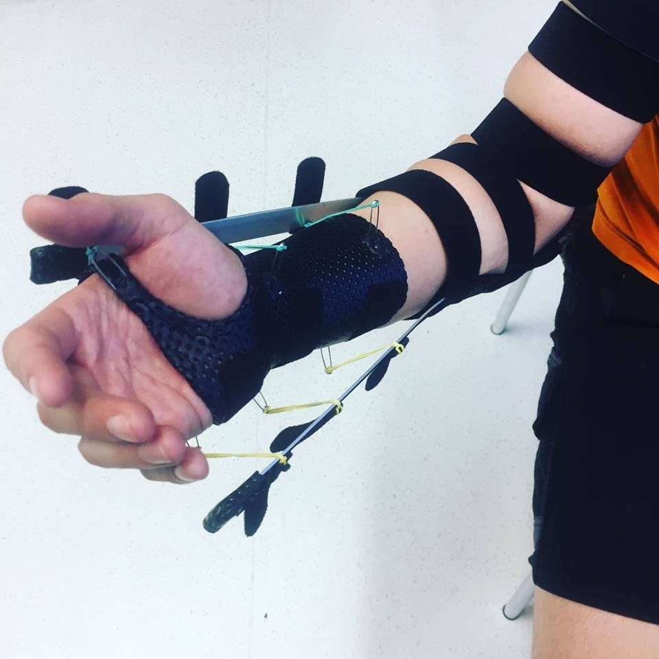 مـن حَقـــي - A collelo splint to help increase forearm... | Facebook