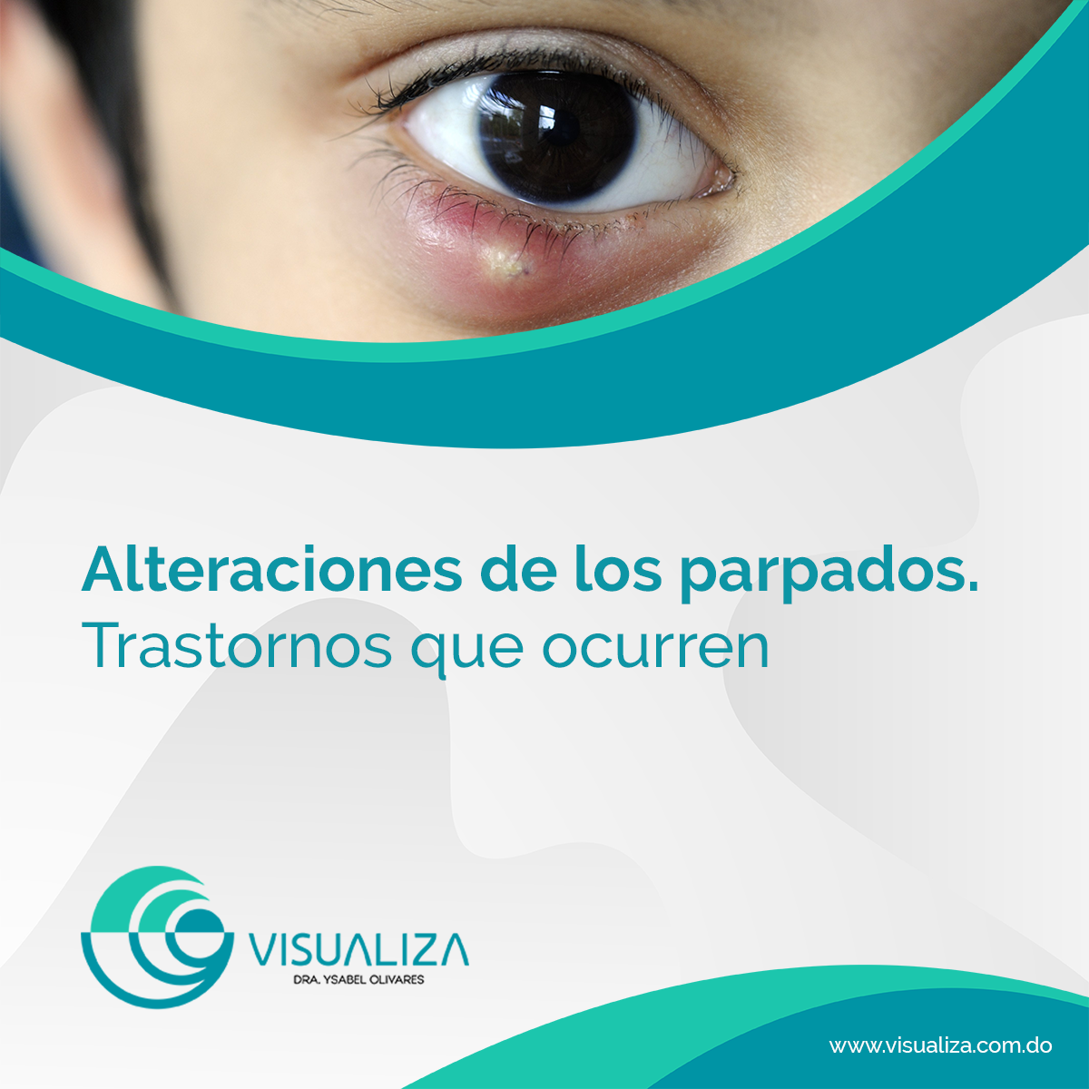 Alteraciones de los... - Visualiza Centro Oftalmológico