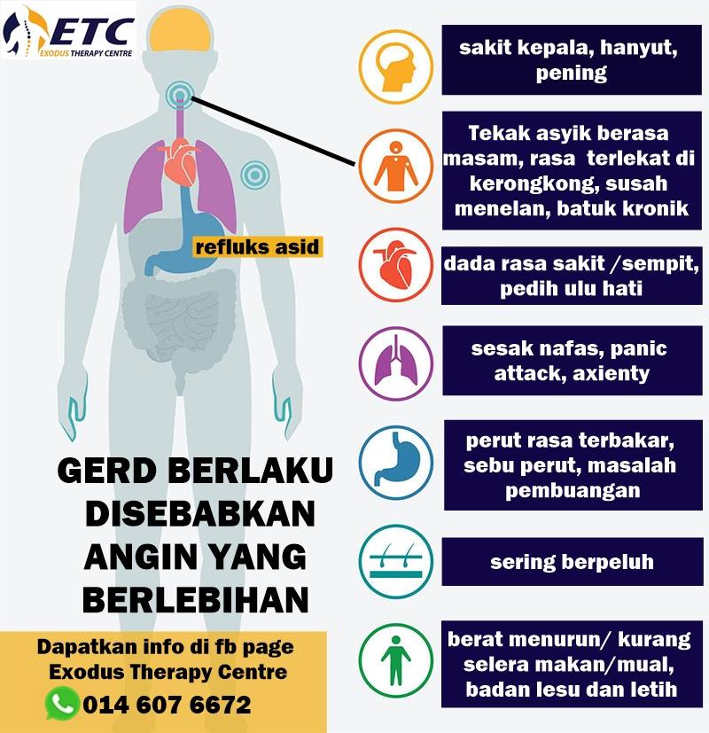 Pakar Buang Angin Ini Bukan Penyakit Mister Dah Banyak Kali Alami Mcm Ni Tapi Tak Tahu Mcm Mana Nak Rawat Sebab Tak Tahu Punca Sebenar Dia Apa 1 Adakah