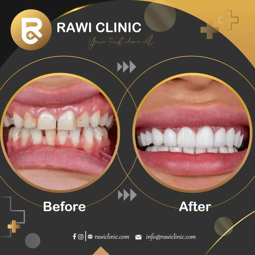 Rawi Clinic Int | Istanbul