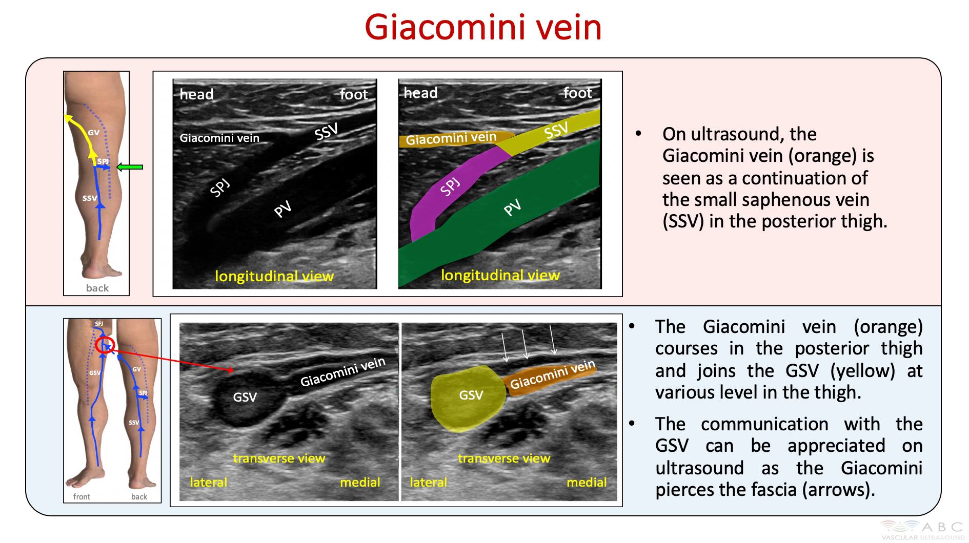 abcvascular-ultrasound-anatomy-is-essential-when