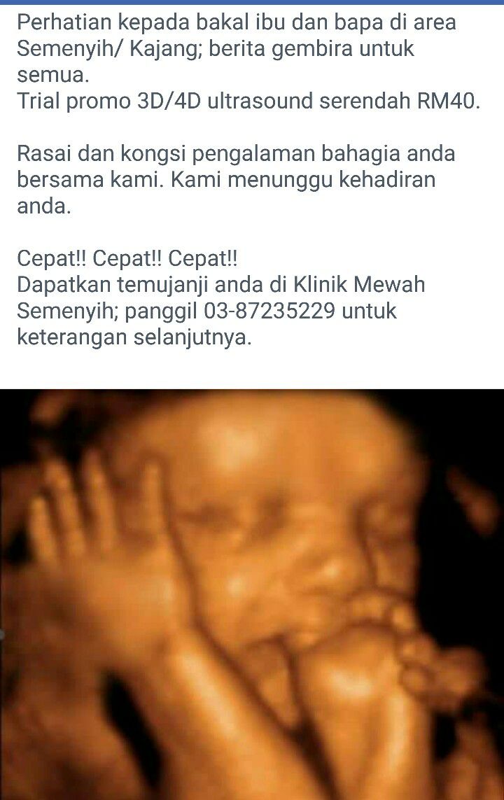 Klinik Mewah Semenyih Home Facebook