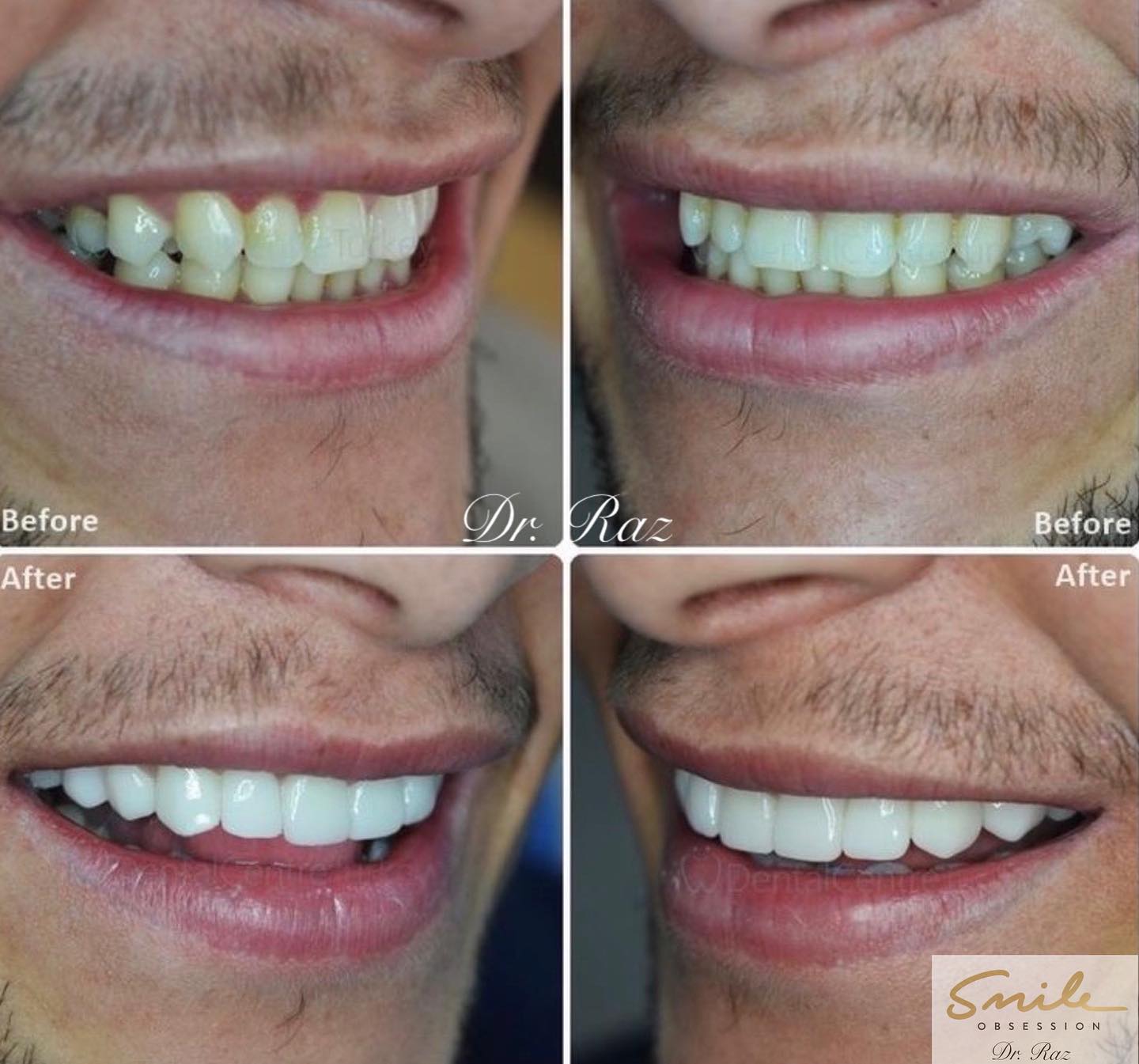 Smile Obsession - ⚡️💥 Always changing lives💥⚡️.. Making...