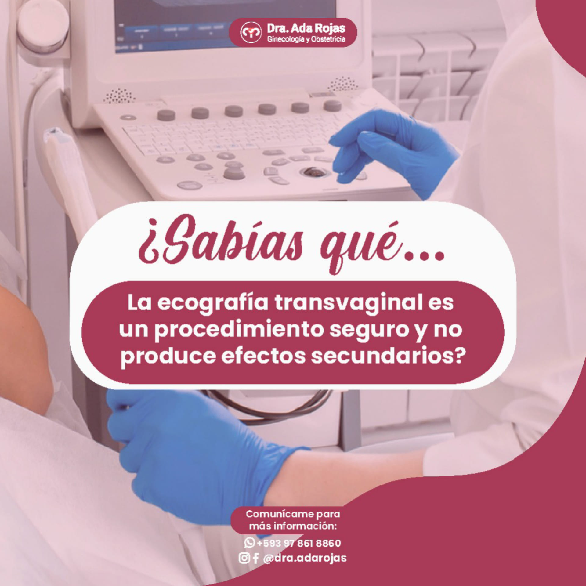 Dra. Ada Rojas - La ecografía transvaginal es un...