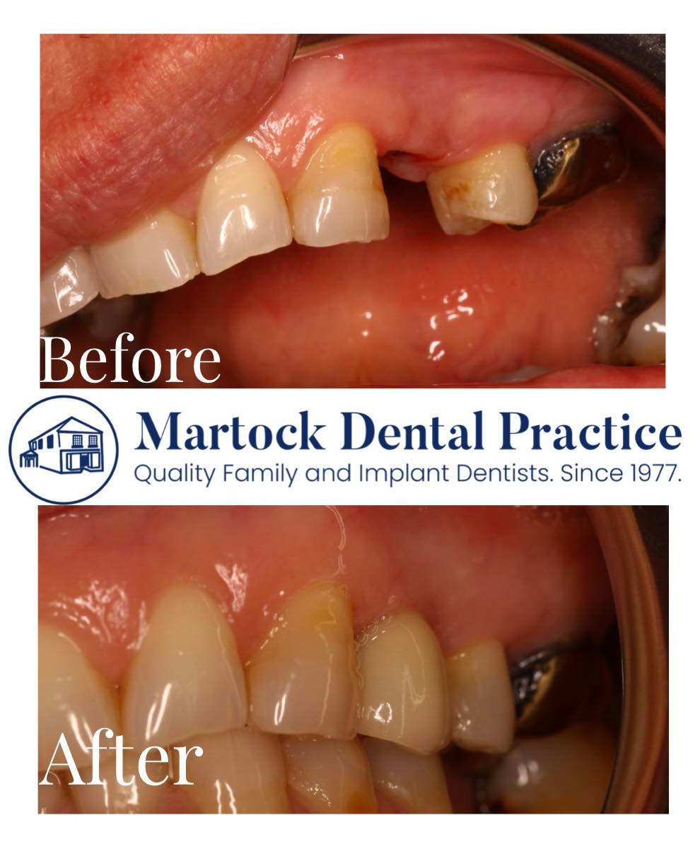 Always a love a before and... - Martock Dental Practice