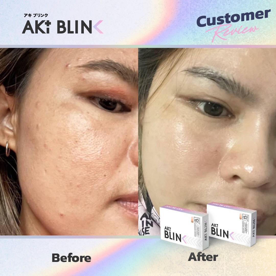 แนะนำการถ่ายรูป... - AKI PLUS - เพจหลักบริษัท