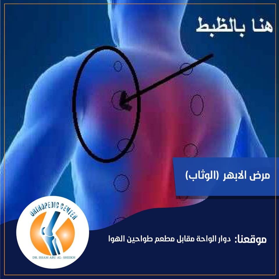 ما هو مرض الابهر الوثاب هو عبارة عن شد التواء في عضلات الكتف ويكون بين لوحيه وبما أن مفصل الكتف يحيط به كثير من العضلات المترابطة