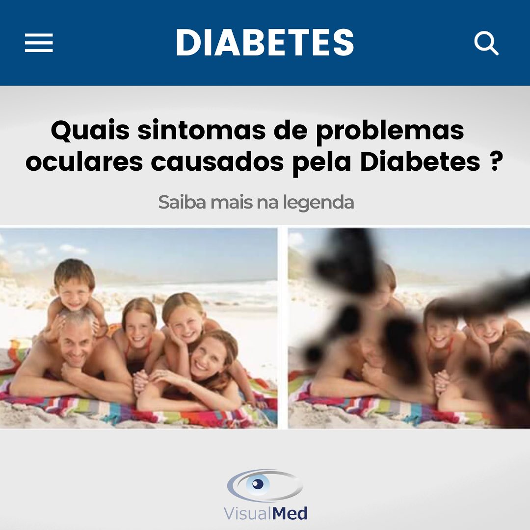 VisualMed - Exame que avalia as possíveis irregularidades ópticas de ...