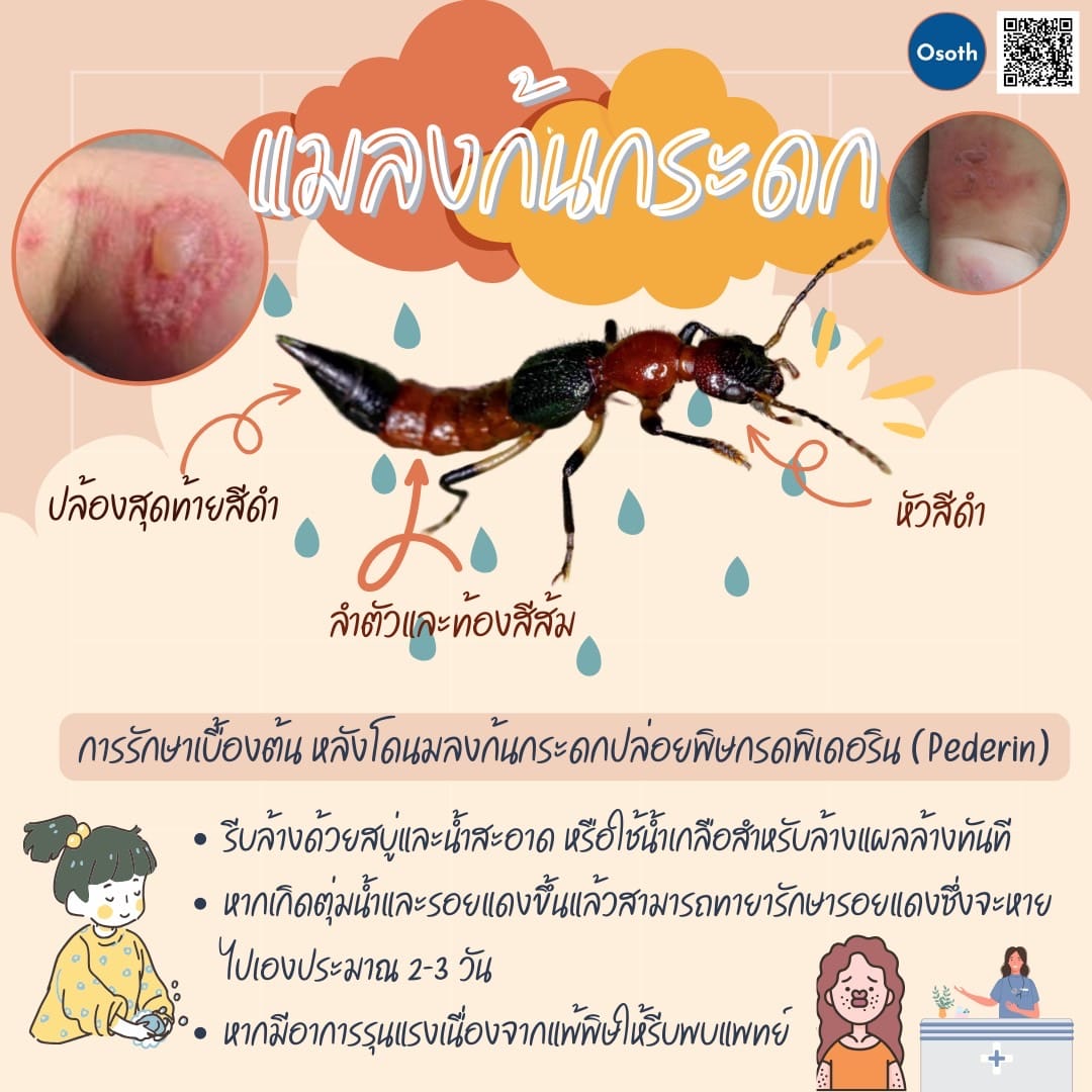 โอสถ Osoth ปรึกษาข้อมูลสุขภาพ ได้ไม่จำกัด ทุกที่ ทุกเวลา