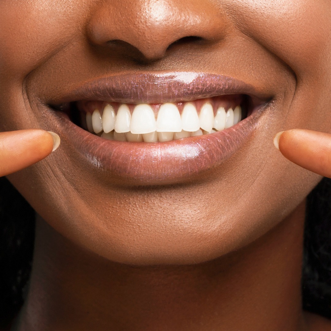 Now, you can achieve that... - Dos Caminos Dental