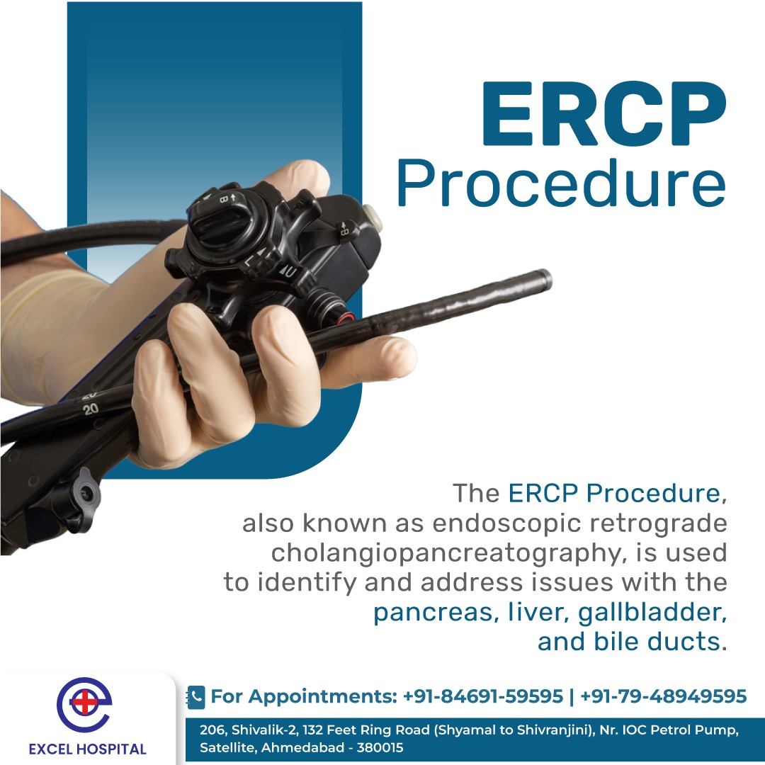 Excel Hospital - The ERCP Procedure, also known as... | Facebook