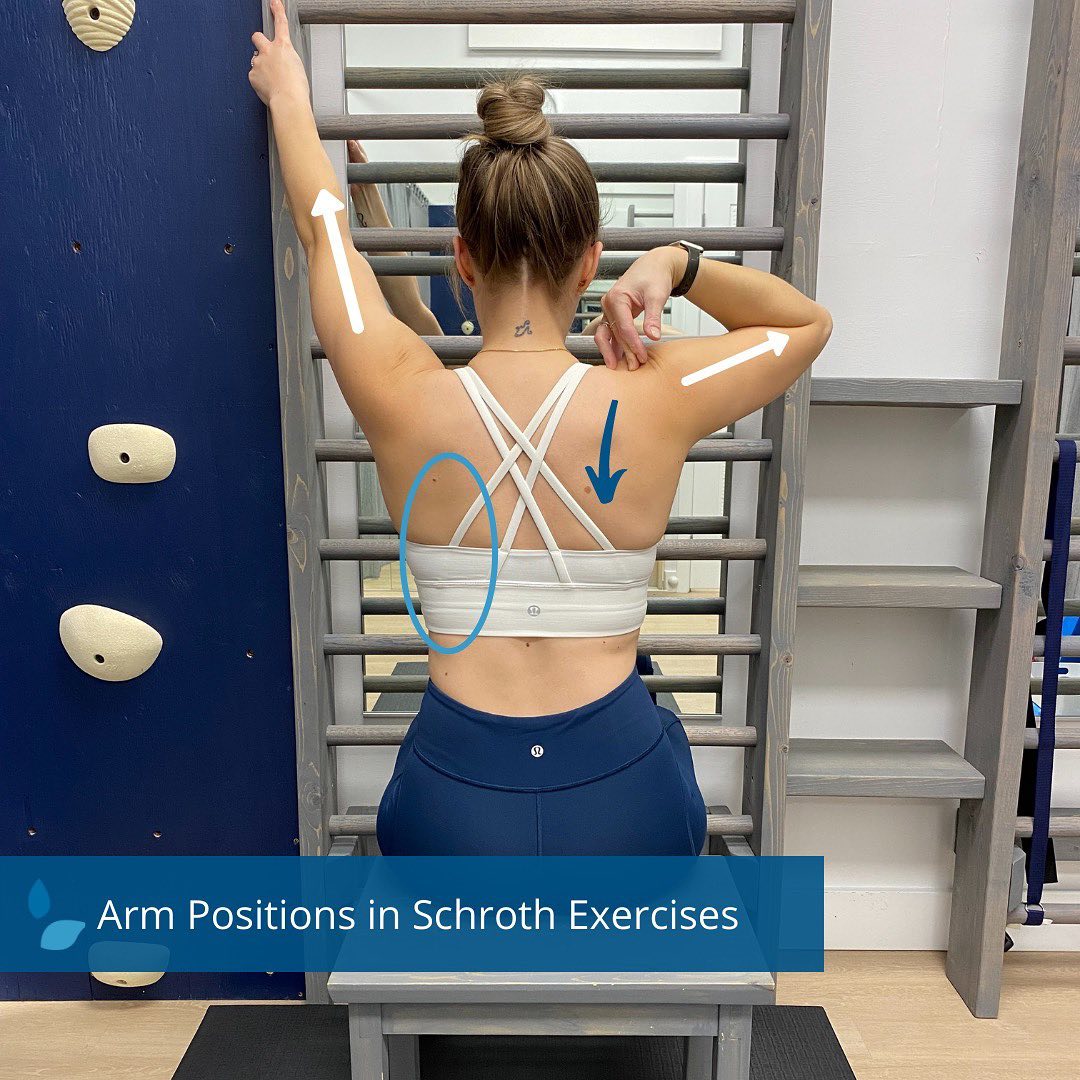 The ScoliClinic - *Arm Positions in Schroth Exercises* . You’ve prob ...