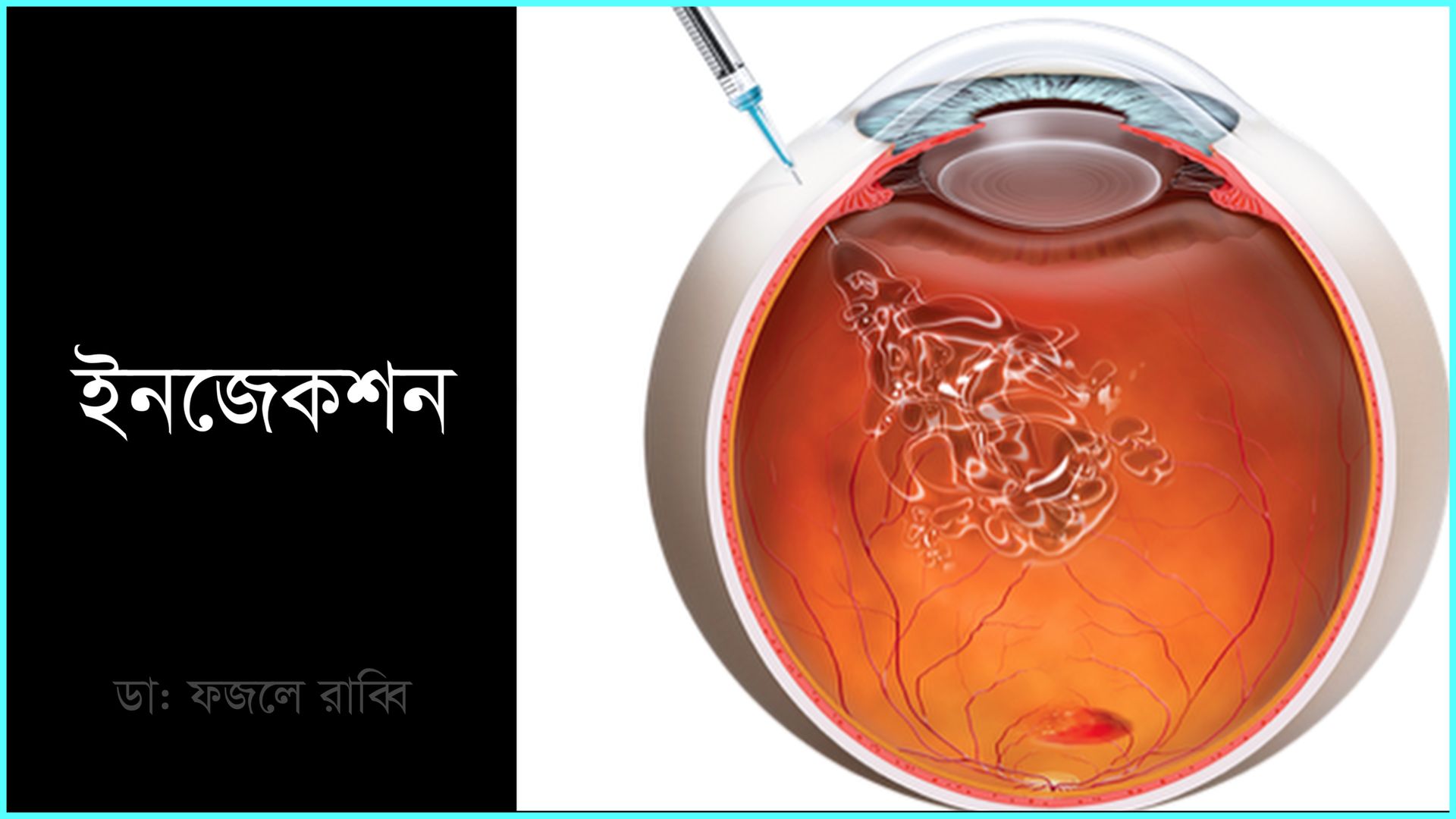 Dr Fazley Rabby- Eye Specialist & Surgeon