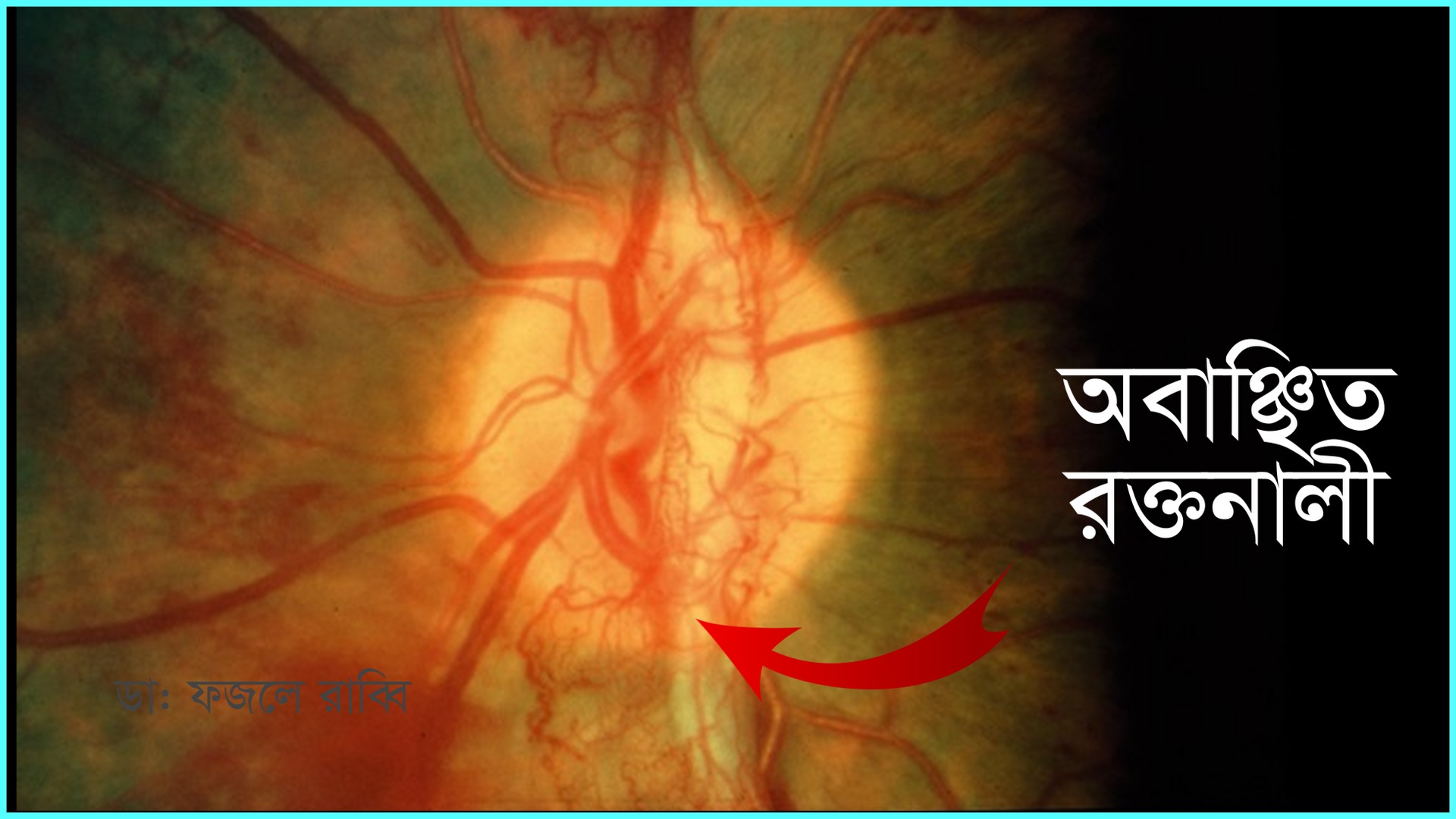 Dr Fazley Rabby- Eye Specialist & Surgeon